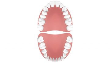 blog-first-teeth